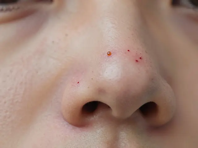 Co je nejlepší na černé tečky? Skutečné řešení, které funguje