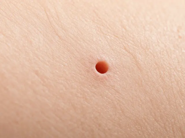 Jak na rozšířené póry: ověřené babské rady a moderní řešení
